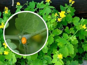 celandine juice to treat plantar warts